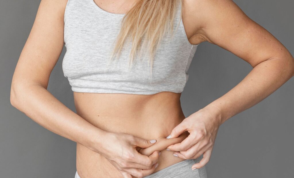 Tummy Tuck