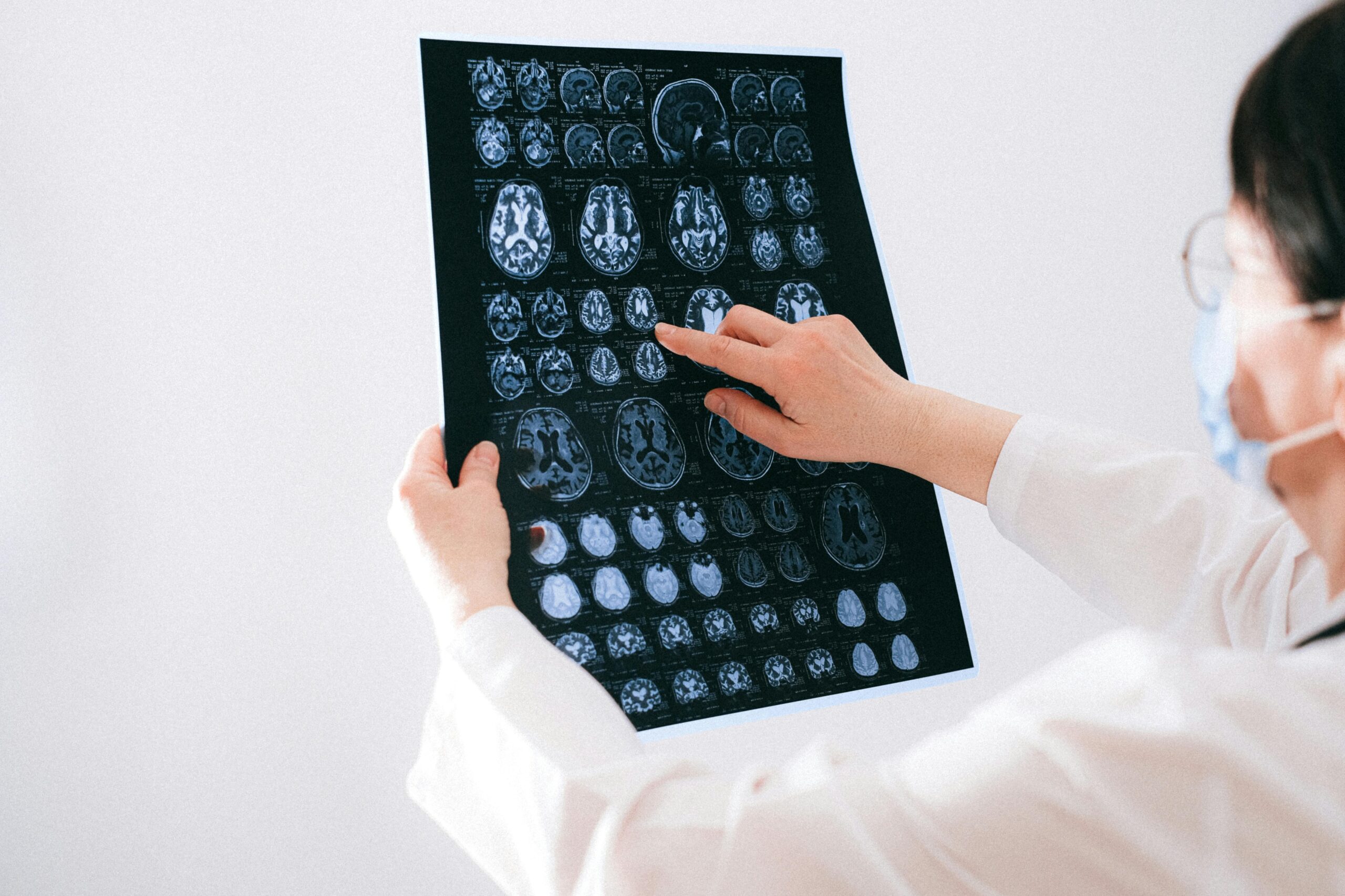 hasil pet scan